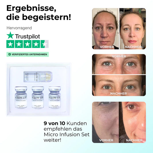 Micro Infusion System Komplett Set ᐅ Falten reduzieren & Haut verjüngen